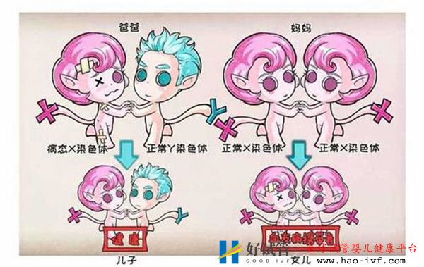 高龄夫妻试管前需要了解传男不传女的三种常见基因遗传疾病(图1)