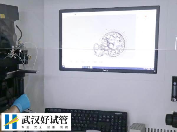 试管移植后怎么做容易成功着床(图1)