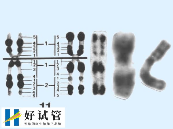 染色体检查可判断胚胎是否异常
