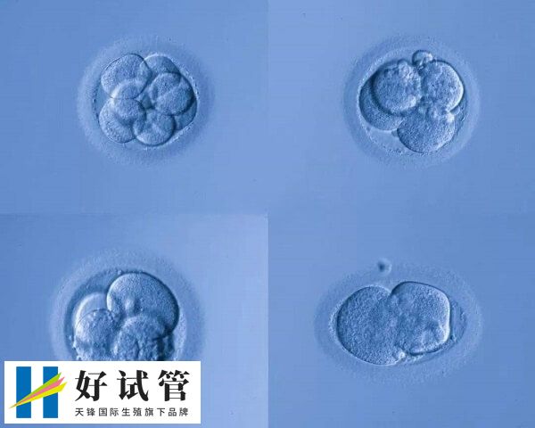 养囊可以提高试管移植成功率