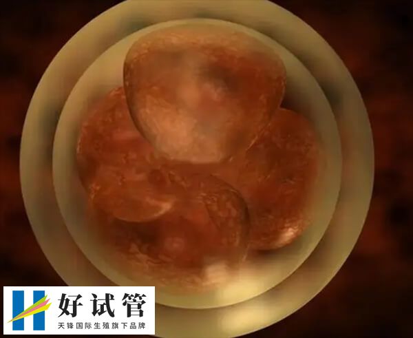 肥胖会影响卵子质量