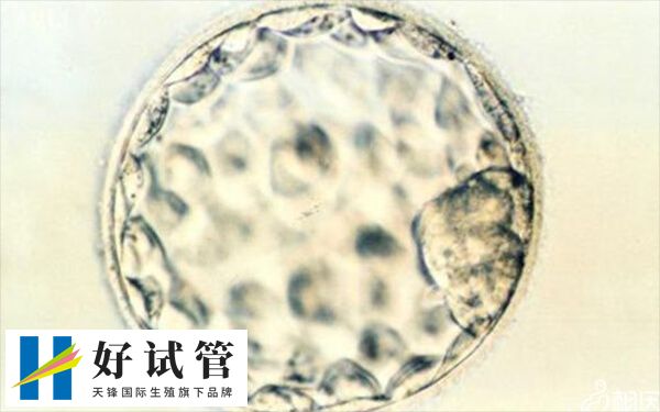 试管着床失败和子宫的健康问题有关