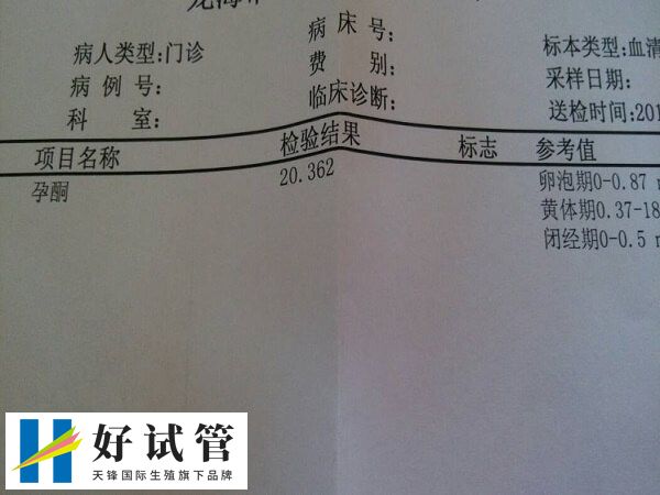 孕酮指标只是相对而不是绝对的参考值
