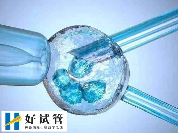 试管移植失败的原因比较多