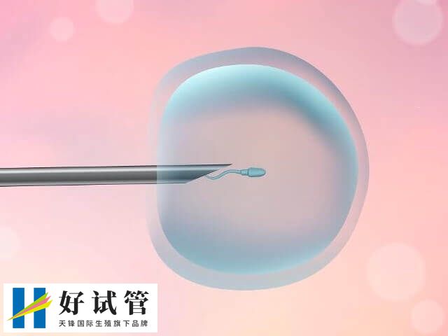 取卵是试管婴儿手术中十分重要的一步