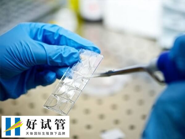 试管取卵过程10-15分钟