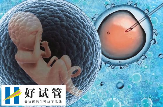 试管婴儿