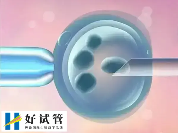 浙大二院做试管前要先进行身体检查