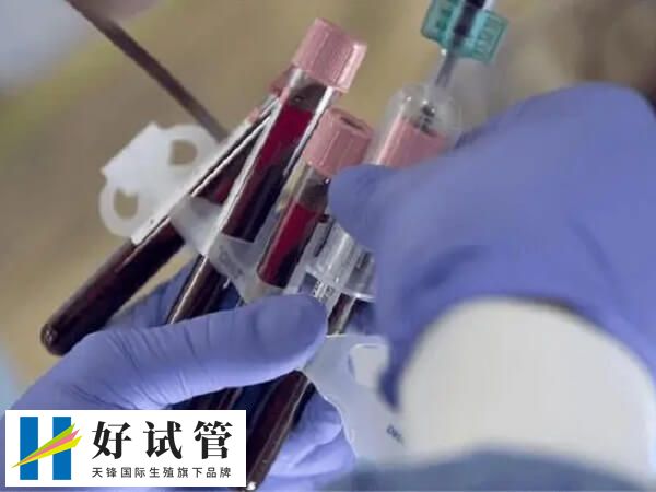 抽血检查血清中的六种激素